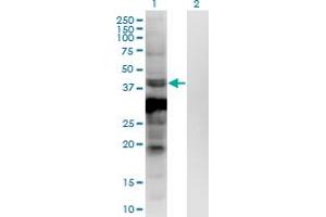 Western Blot analysis of ASB5 expression in transfected 293T cell line by ASB5 monoclonal antibody (M03), clone 6B10.