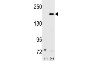 Western blot analysis of SRC-1 antibody and 293 cell lysate (2 ug/lane) either nontransfected (Lane 1) or transiently transfected with the NCOA1 gene (2).