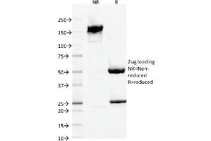 SDS-PAGE Analysis Purified AIF1 / Iba1 Mouse Monoclonal Antibody (AIF1/1909). (Iba1 anticorps  (AA 1-146))