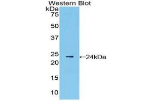 Western blot analysis of the recombinant protein. (IFNB1 anticorps  (AA 22-187))