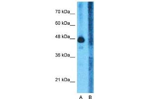 Host:  Rabbit  Target Name:  GLUD1  Sample Type:  Human Fetal Liver  Lane A:  Primary Antibody  Lane B:  Primary Antibody + Blocking Peptide  Primary Antibody Concentration:  1ug/ml  Peptide Concentration:  5ug/ml  Lysate Quantity:  25ug/lane/lane  Gel Concentration:  0.