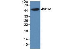 Western Blot; Sample: Recombinant a1AGP, Rat. (ORM1 anticorps  (AA 19-186))