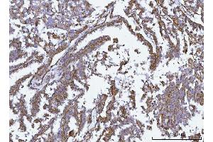 IHC analysis of GLUD1/2 using anti-GLUD1/2 antibody (ABIN7602000). (GLUD1 / GLUD2 (AA 54-553) anticorps)