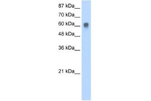 WB Suggested Anti-ZFP91 Antibody Titration:  0. (ZFP91 anticorps  (N-Term))