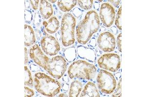 Immunohistochemistry of paraffin-embedded rat kidney using TST Rabbit pAb  at dilution of 1:200 (40x lens).