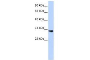 Image no. 1 for anti-Fibroblast Growth Factor 2 (Basic) (FGF2) (C-Term) antibody (ABIN6743086) (FGF2 anticorps  (C-Term))