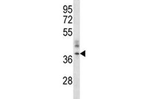 CRACM1 antibody western blot analysis in A375 lysate. (ORAI1 anticorps  (AA 269-298))