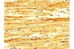 IHC image of ABIN7152598 diluted at 1:300 and staining in paraffin-embedded human heart tissue performed on a Leica BondTM system.