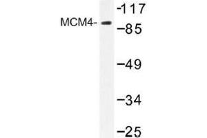 Image no. 1 for anti-Minichromosome Maintenance Deficient 4 (MCM4) antibody (ABIN317884) (MCM4 anticorps)