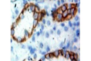 Used in DAB staining on fromalin fixed paraffin-embedded Kidney tissue