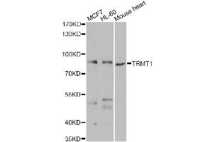 Western blot analysis of extracts of various cell lines, using TRMT1 antibody. (TRMT1 anticorps)