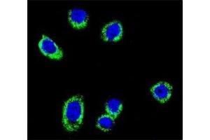 Confocal immunofluorescent analysis of BRAF antibody with HeLa cells followed by Alexa Fluor 488-conjugated goat anti-rabbit lgG (green).