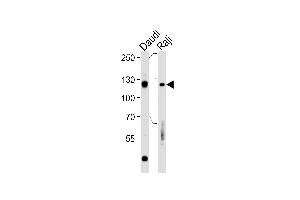 Rb Antibody  (ABIN1881730 and ABIN2840685) western blot analysis in Daudi,Raji cell line lysates (35 μg/lane). (Retinoblastoma 1 anticorps  (AA 586-615))