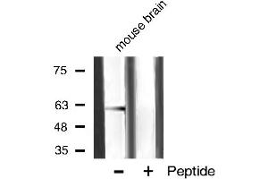 Western blot analysis of akt2 phosphorylation expression in mouse brain tissue lysates,The lane on the right is treated with the antigen-specific peptide. (AKT2 anticorps  (pSer474))