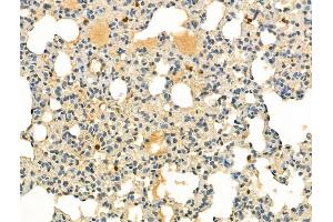 ABIN6255286 and ABIN6267647 at 1/100 staining Rat lung tissue by IHC-P. (IRF3 anticorps  (pSer386))