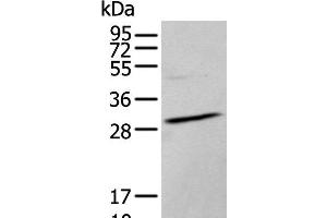 Western blot analysis of TM4 cell lysate using HOXC9 Polyclonal Antibody at dilution of 1:350 (HOXC9 anticorps)