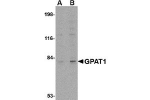 Western Blotting (WB) image for anti-Glycerol-3-Phosphate Acyltransferase, Mitochondrial (GPAM) (C-Term) antibody (ABIN1030417)