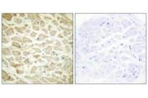 Immunohistochemistry analysis of paraffin-embedded human heart tissue using Collagen XIV α1 antibody.