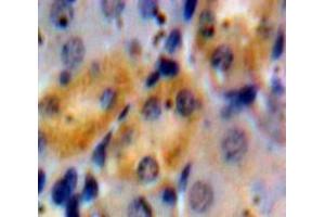 Used in DAB staining on fromalin fixed paraffin-embedded Kidney tissue