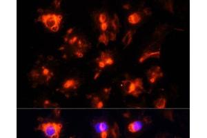 Immunofluorescence analysis of HUVEC cells using CD31 Polyclonal Antibody at dilution of 1:100. (CD31 anticorps)