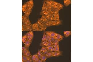Immunofluorescence analysis of U2OS cells using PFKL antibody (ABIN7269308) at dilution of 1:100. (PFKL anticorps  (AA 700-780))