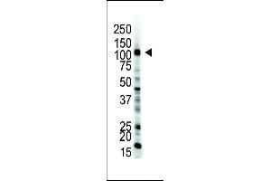The anti-UBE1 Pab (ABIN388844 and ABIN2839150) is used in Western blot to detect UBE1 in HL-60 cell lysate. (E1 Ubiquitin (AA 1026-1058), (C-Term) anticorps)