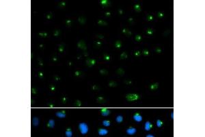 Immunofluorescence analysis of MCF-7 cells using PSAP Polyclonal Antibody (Prosaposin anticorps)