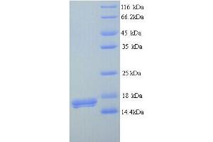 SDS-PAGE (SDS) image for Triggering Receptor Expressed On Myeloid Cells 5 (TREM5) (AA 18-151) protein (His tag) (ABIN5713332)