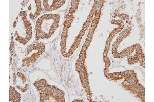IHC-P Image Immunohistochemical analysis of paraffin-embedded OVCA xenograft, using ERAB, antibody at 1:100 dilution.