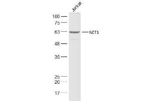 Jurkat lysates probed with NET1 Polyclonal Antibody, Unconjugated  at 1:1000 dilution and 4˚C overnight incubation. (NET1 anticorps  (AA 501-596))