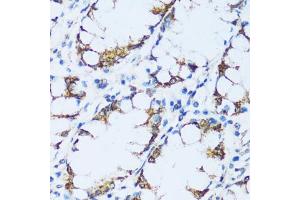 Immunohistochemistry of paraffin-embedded human colon using C1QC antibody (ABIN7266475) at dilution of 1:100 (40x lens).