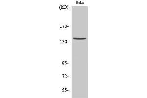 Western Blot (WB) analysis of specific cells using Cleaved-Spectrin alpha II (D1185) Polyclonal Antibody. (SPTAN1 anticorps  (Asp1185, cleaved))