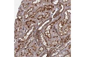 Immunohistochemical staining of human kidney with ITPKA polyclonal antibody  shows strong membranous and cytoplasmic positivity in tubular cells at 1:200-1:500 dilution.