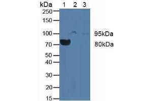 Western blot analysis of (1) Rat Blood Cells, (2) Human JAR Cells and (3) Human Placenta Tissue. (CSF3R anticorps  (AA 26-138))