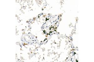 Immunohistochemistry of paraffin-embedded human lung using  Rabbit mAb (ABIN7265424) at dilution of 1:1000 (40x lens). (ACSL4 anticorps)