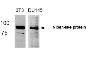 Western Blotting (WB) image for anti-Family with Sequence Similarity 129, Member B (FAM129B) (AA 710-714) antibody (ABIN363055) (MEG3 anticorps  (AA 710-714))