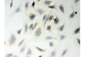 IHC analysis of LYRIC using anti-LYRIC antibody .