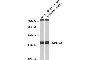 Western blot analysis of extracts of various cell lines, using MYBPC2 antibody (ABIN6129608, ABIN6144218, ABIN6144220 and ABIN6222676) at 1:1000 dilution. (MYBPC2 anticorps  (AA 912-1141))