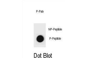 Dot blot analysis of CCNB1 Antibody (Phospho S35) Phospho-specific Pab (ABIN1881155 and ABIN2839973) on nitrocellulose membrane.