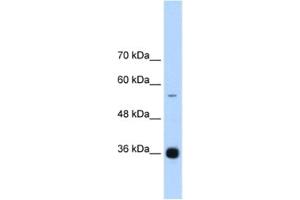 Western Blotting (WB) image for anti-Heterogeneous Nuclear Ribonucleoprotein A/B (HNRNPAB) antibody (ABIN2462311) (HNRNPAB anticorps)