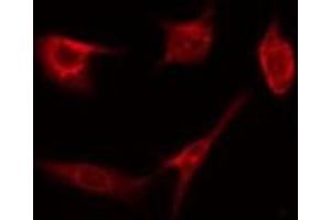 ABIN6274661 staining HepG2 by IF/ICC.