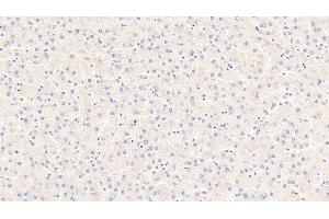 Detection of PCK2 in Human Liver Tissue using Polyclonal Antibody to Phosphoenolpyruvate Carboxykinase 2, Mitochondrial (PCK2) (PEPCK anticorps  (AA 33-198))