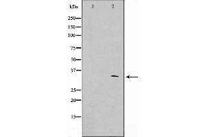 Western blot analysis on HuvEc cell lysate using APC Antibody,The lane on the left is treated with the antigen-specific peptide.