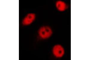 ABIN6269111 staining 293 by IF/ICC.