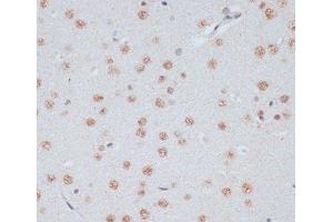 Immunohistochemistry of paraffin-embedded Rat brain using Phospho-ERK1(T202/Y204)/ ERK2(T185/Y187) Polyclonal Antibody at dilution of 1:100 (40x lens).