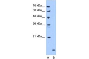Western Blotting (WB) image for anti-Crystallin, alpha B (CRYAB) antibody (ABIN2463152) (CRYAB anticorps)