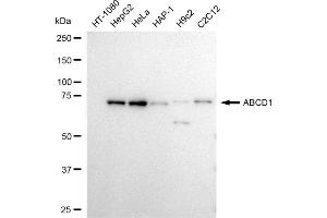 Western blotting analysis using ABCD1 antibody (ABIN7797686).