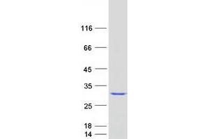 Validation with Western Blot