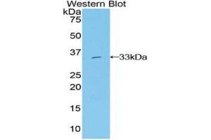 Western Blotting (WB) image for anti-Growth Factor Receptor-Bound Protein 7 (GRB7) (AA 66-327) antibody (ABIN1859067)
