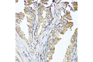 Immunohistochemistry of paraffin-embedded human prostate using STK3 antibody. (STK3 anticorps)